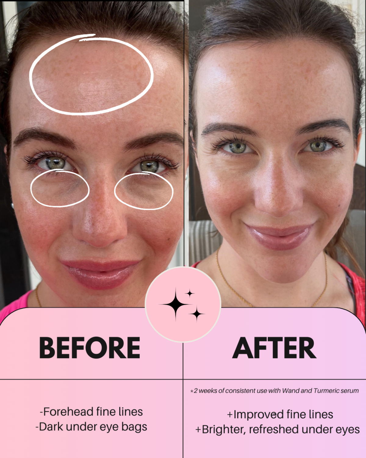 4-in-1 Ultimate Radiant Skincare Wand