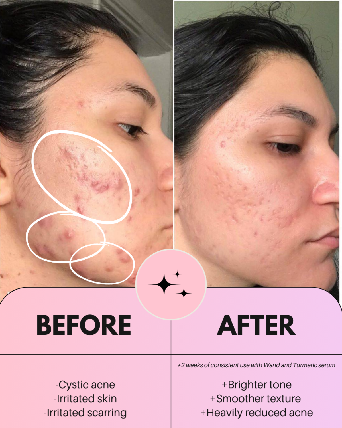 4-in-1 Ultimate Radiant Skincare Wand