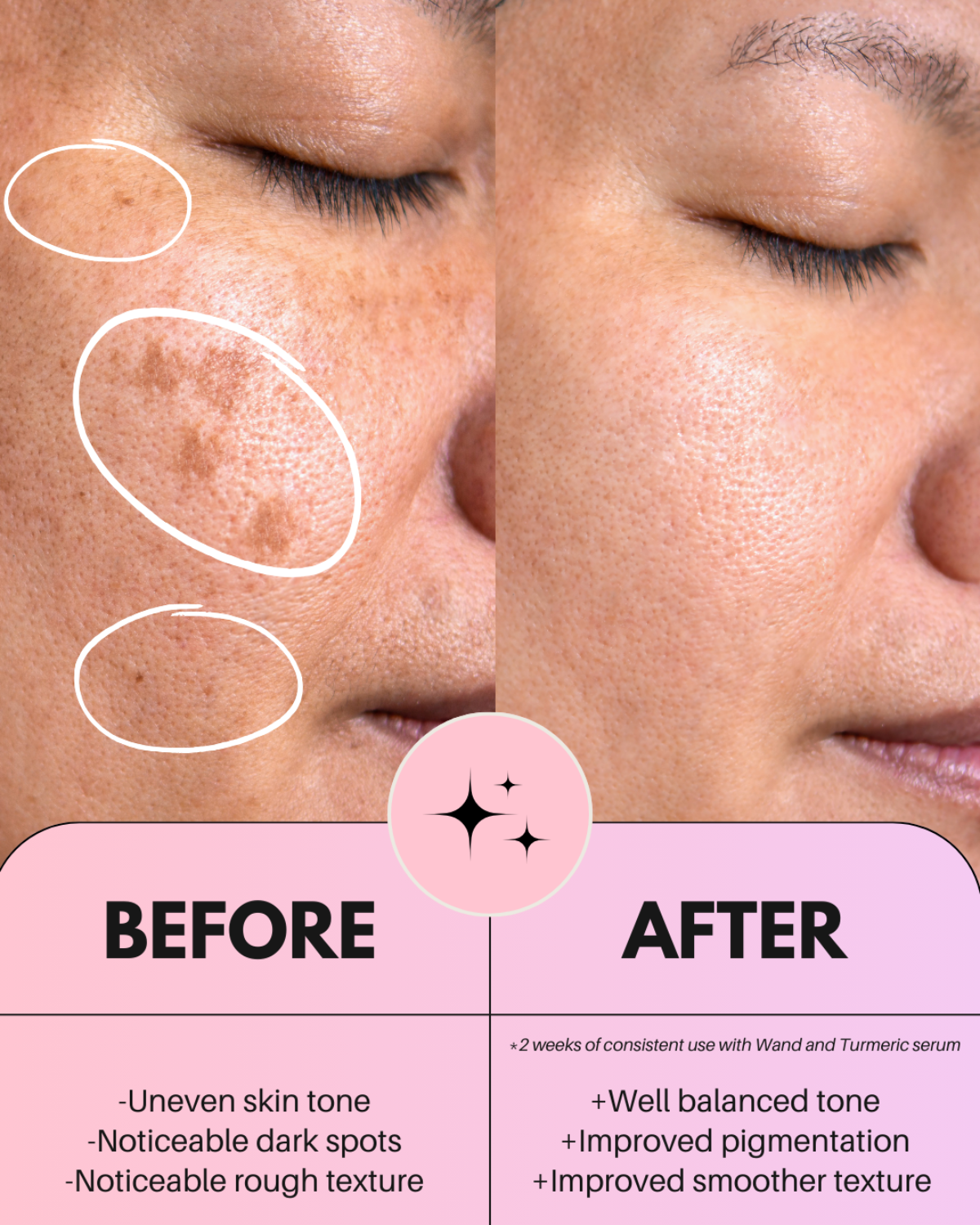 4-in-1 Ultimate Radiant Skincare Wand